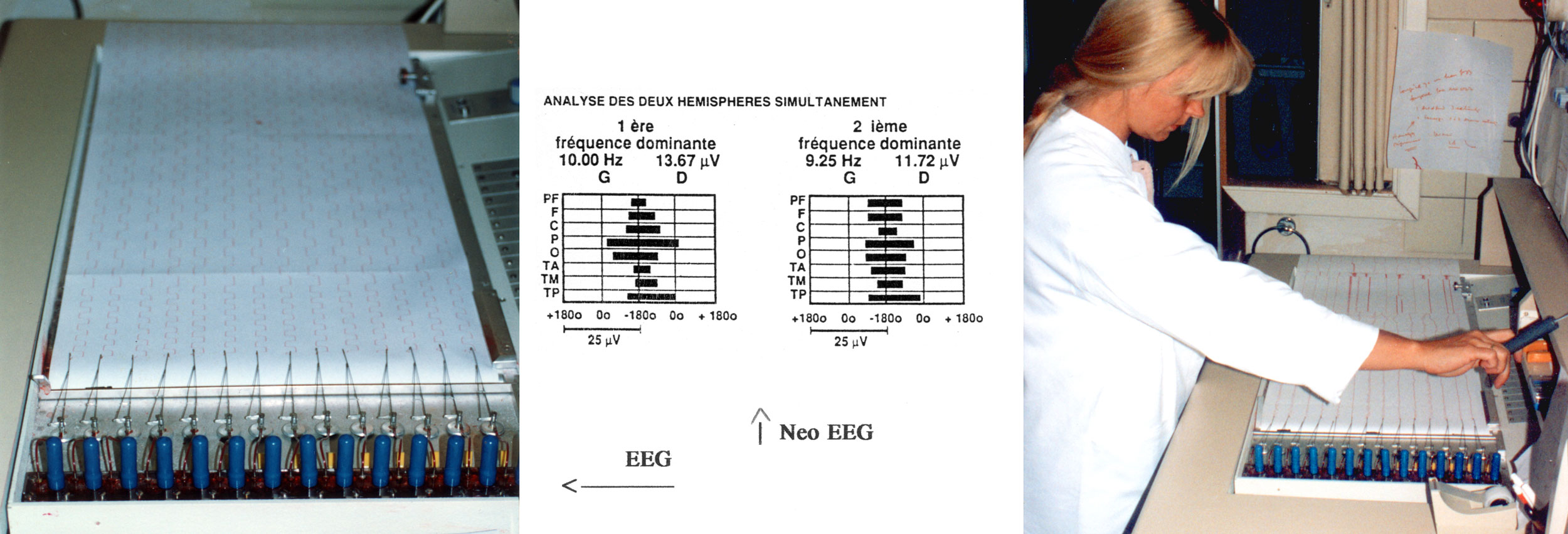 EEG et Neo EEG